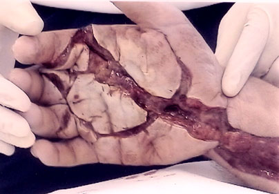 Fig 16